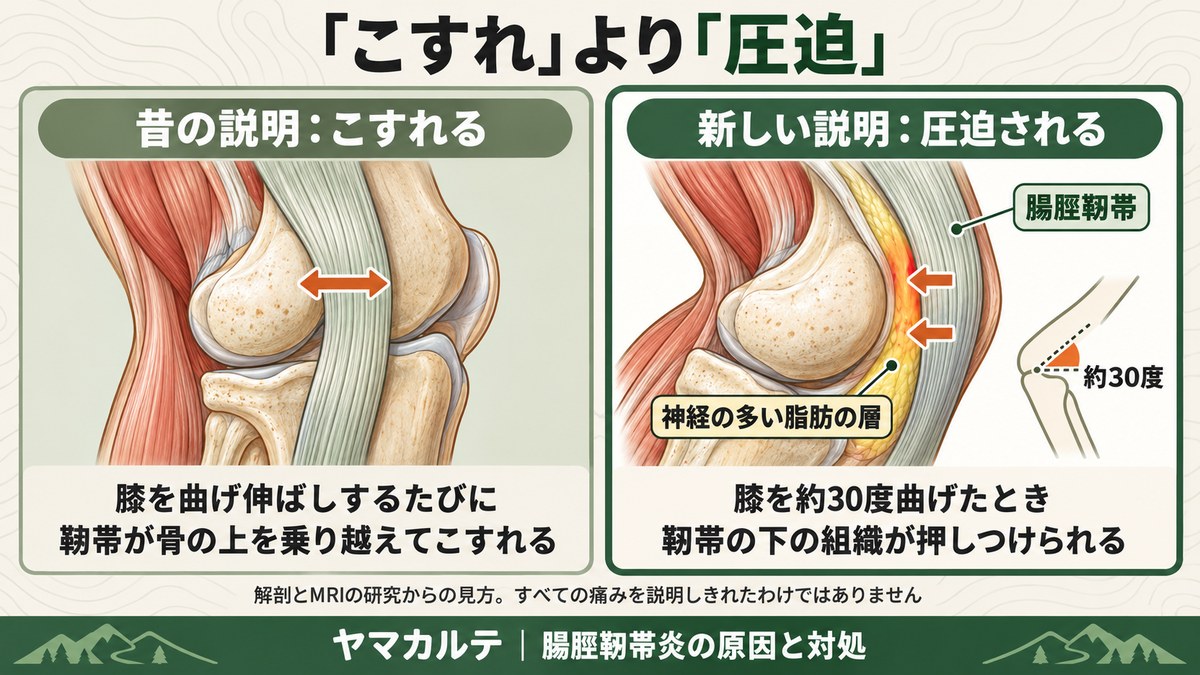 腸脛靭帯炎のしくみ こすれより圧迫 昔の説明は膝の曲げ伸ばしで靭帯が骨の上を乗り越えてこすれる 新しい説明は膝を約30度曲げたとき靭帯の下の神経の多い脂肪の層が押しつけられる ヤマカルテ